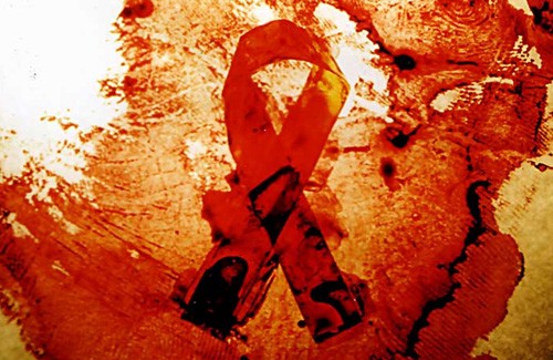 СПИД в Полтавской области давно вырвался из состояния «андерграунда»