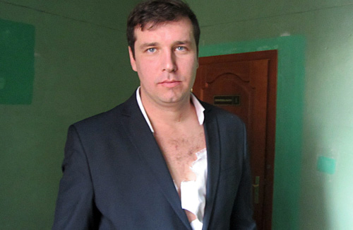 Александр Шамота в разорваной рубашке