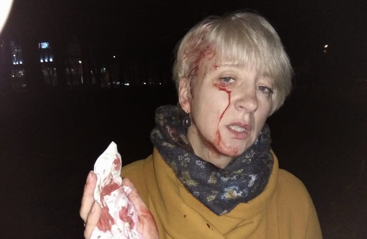Лариса Гольник після нападу