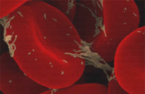 Червоні клітини крові, атаковані паразитами