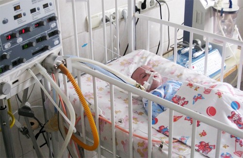 Двомісячне немовля у реанімаційному відділенні дитячої лікарні