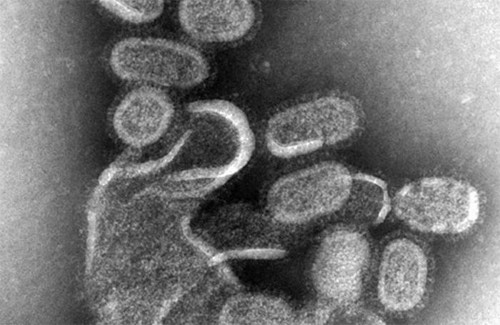 Мікрофотографія вірусу грипу, знятого за допомогою електронного мікроскопу