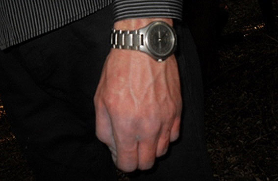 Часы на руке мужчины, найденного повешенным в лесу