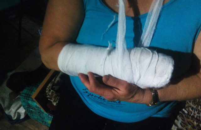 Невідомі нападники зламали руку Надії Мустафіній