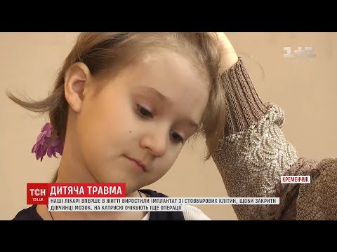 Слідчі протягом 2,5 років не можуть знайти винних у травмуванні дівчинки в дитсадочку Кременчука