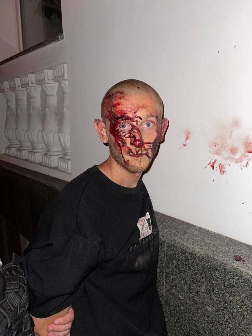 Роман Заволока з розбитим обличчям після затримання